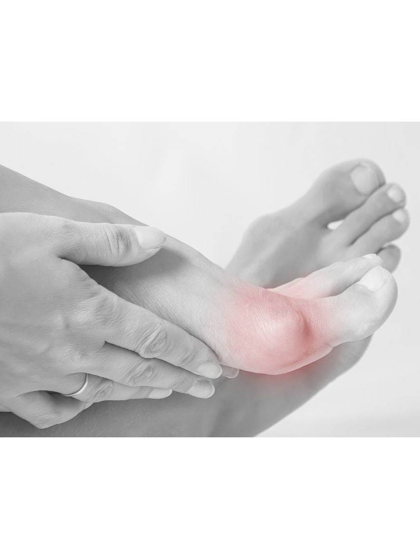 Produktbild von Hallux Balsam 100 ml