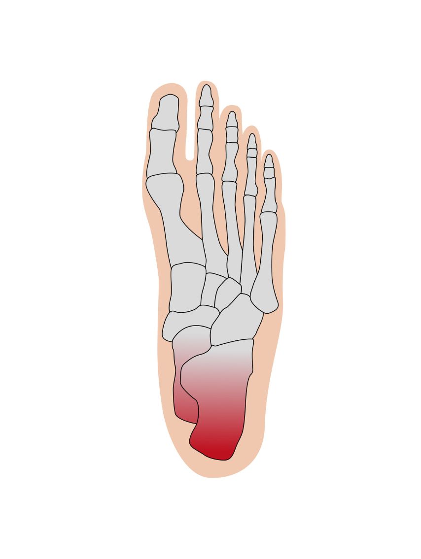Produktbild von Fersenentlastungspolster