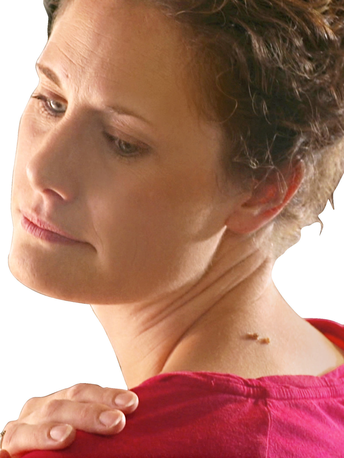 Produktbild von FormuClear Skin Tag Patch